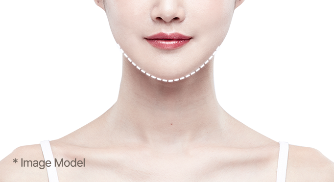 Chin surgery